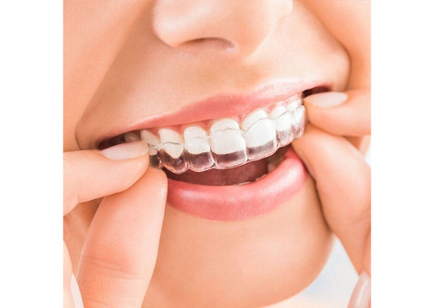 Get the Best Invisalign in Mumbai for a Confident Smile