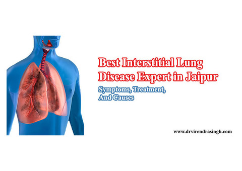 Best Interstitial Lung Disease Expert in Jaipur