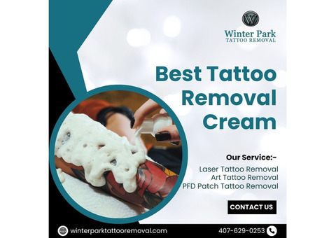 Best Tattoo Removal Cream – Fade Ink at Home