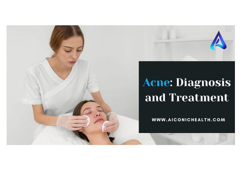 Acne: Diagnosis and Treatment | Aiconic Health