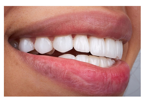 Get a Stunning Smile with the Best Cosmetic Dentist in North Miami