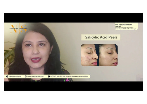 Pigmentation Treatment In Gurgaon - Estique Clinic