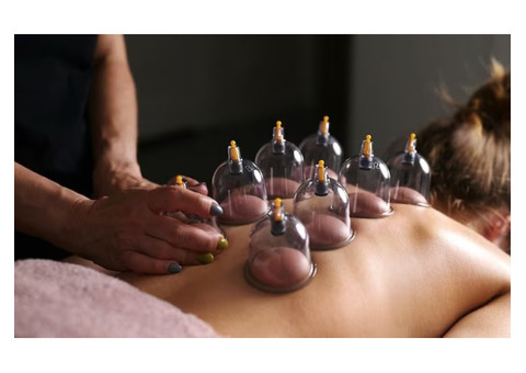 Experience Cupping Therapy in Farringdon for Pain Relief