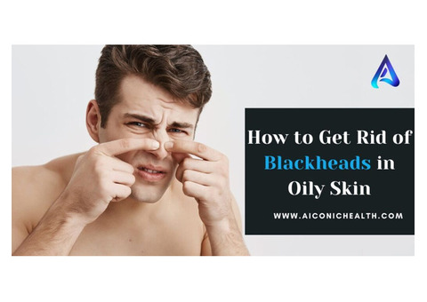 How to Get Rid of Blackheads in Oily Skin | Aiconic Health