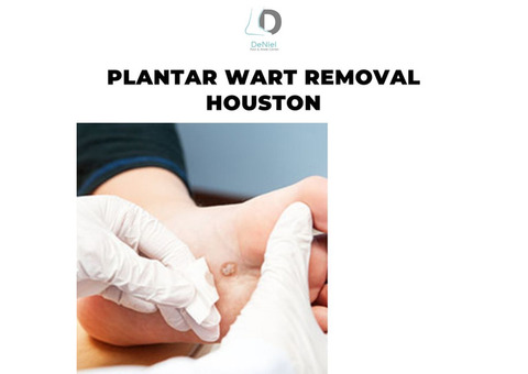 Expert Plantar Warts Treatment for Lasting Relief