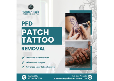 PFD Patch Tattoo Removal – Faster & Fewer Sessions