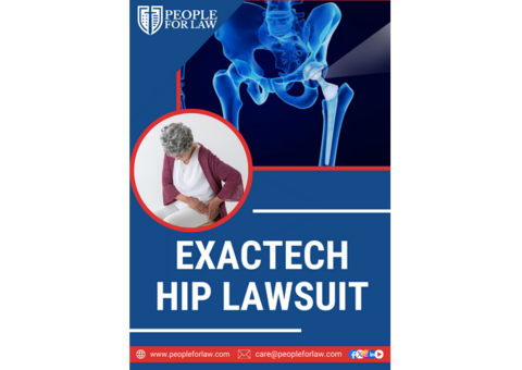 Exactech Hip Lawsuit in Florida - People For Law