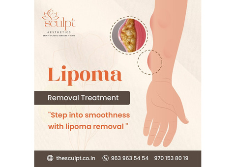 lipoma treatment in hyderabad