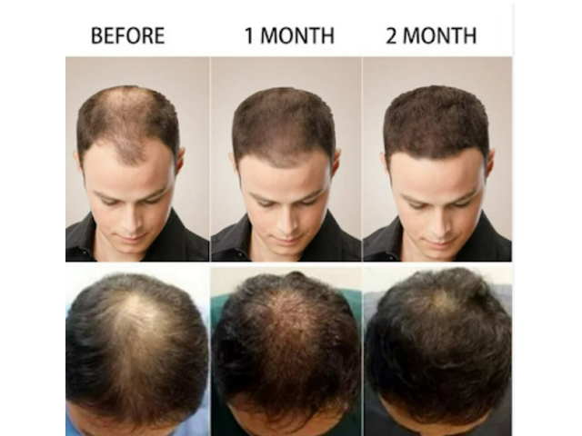 https://www.facebook.com/ReGenixalHairRecoverStore https://www.facebook.com/ReGenixalHairRecoverStore