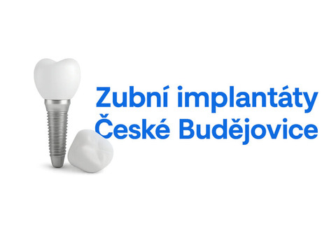 Zubní implantáty České Budějovice