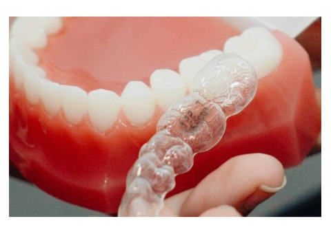 Easy and Comfortable Non-Surgical Dental Implants