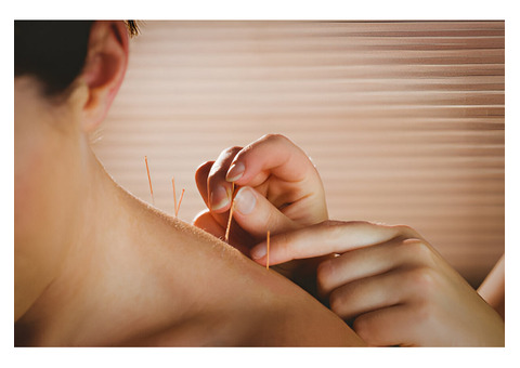 Acupuncture Therapy in Connecticut
