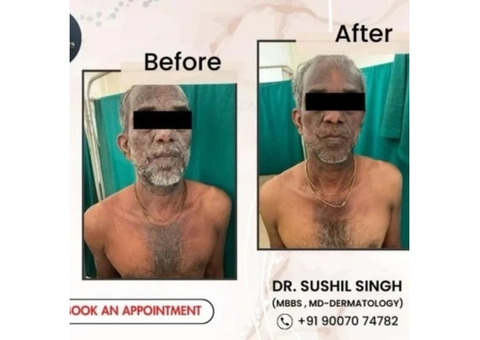 Your Trusted Skin Doctor Behala Visit Dr Sushil Singh