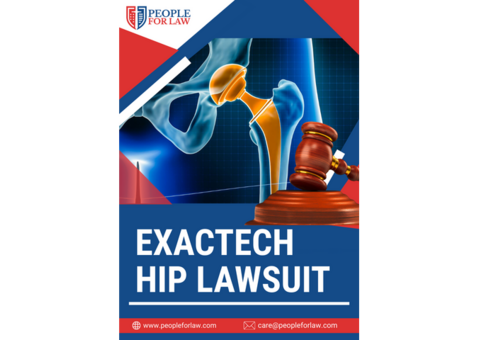 Exactech Hip Lawsuit - People For Law