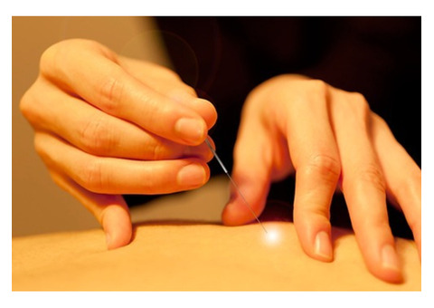 Acupuncture NYC