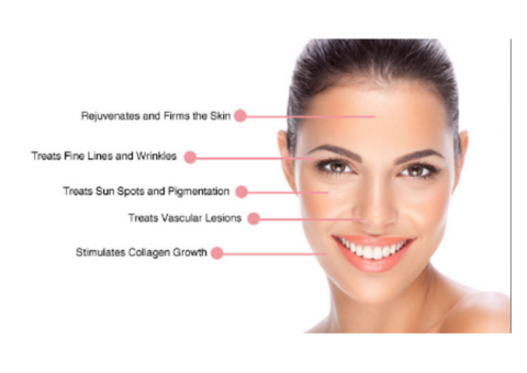 Acne Treatment in Upper Mount Gravatt