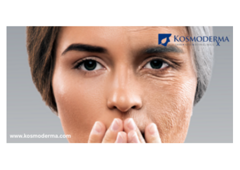 Anti-Aging Skin Care and Treatment in Bangalore - Kosmoderma