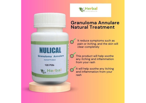 Herbal Supplement for Granuloma Annulare