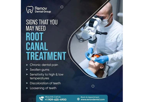 Root Canals in Claremont