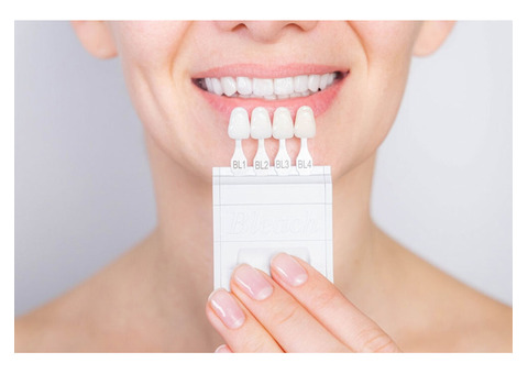 Dental Veneers in Claremont