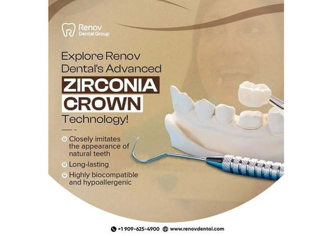 Dental Crowns in Claremont
