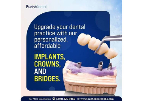 tooth preparation for all ceramic crown