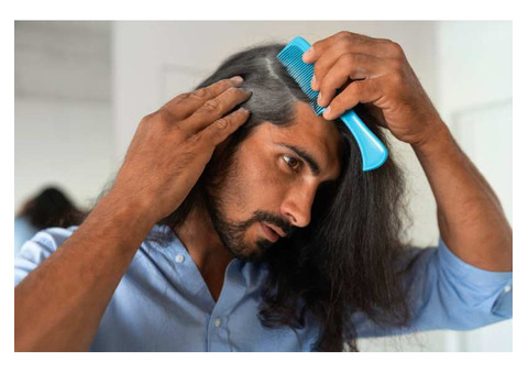 Best Hair Treatment in Bilaspur | Saluja Skin Clinic