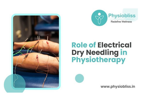 What is Electrical Dry Needling in Physiotherapy?